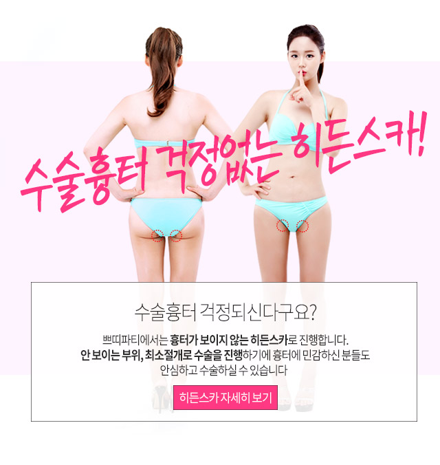 히든스카